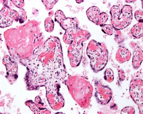 Placenta Histology Stock Photos Free And Royalty Free Stock Photos From