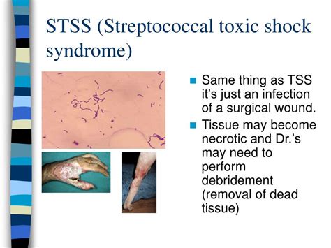 Ppt Toxic Shock Syndrome Powerpoint Presentation Free Download Id