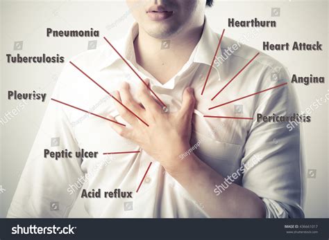 Chest anatomy images stock photos vectors shutterstock. Chest Pain Causes Disease Diagram Stock Photo 436661017 - Shutterstock
