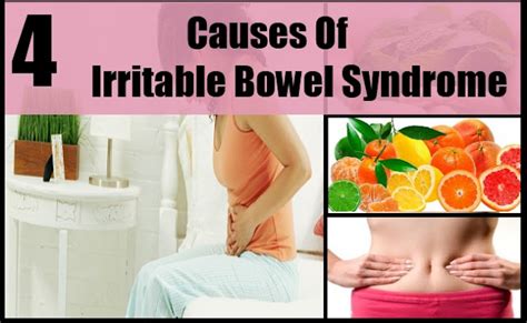 Cure Irritable Bowel Syndrome At Miric Biotech Limited
