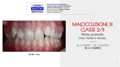 Studio Dentistico Balestro Malocclusione Di Classe 2 2