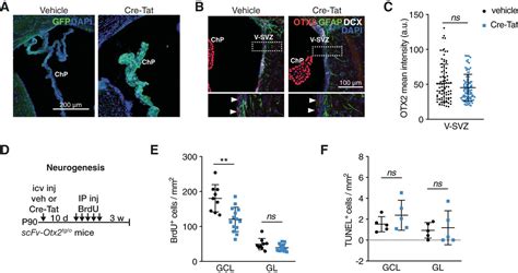 Otx2 Signals From The Choroid Plexus To Regulate Adult Neurogenesis