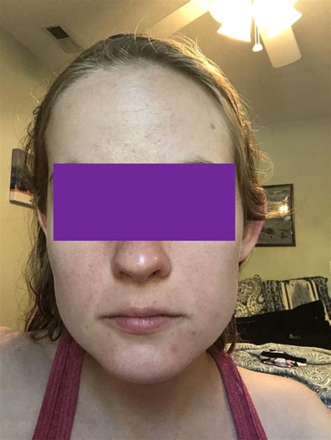 Routine Help What Can I Do To Start Out Skincareaddiction