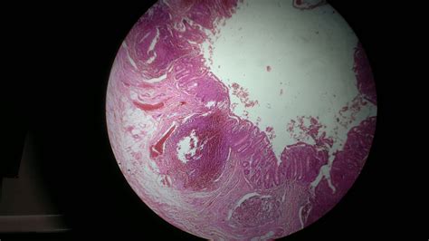 Filehistology Of Human Appendix Wikimedia Commons