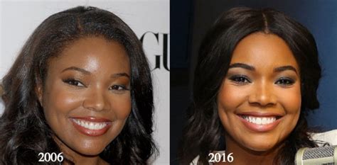 Gabrielle Union Plastic Surgery Rumors Compare Before And After Photos