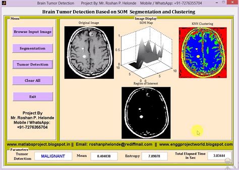 Brain Tumor Detection On Mri Images Using Segmentation And Clustering