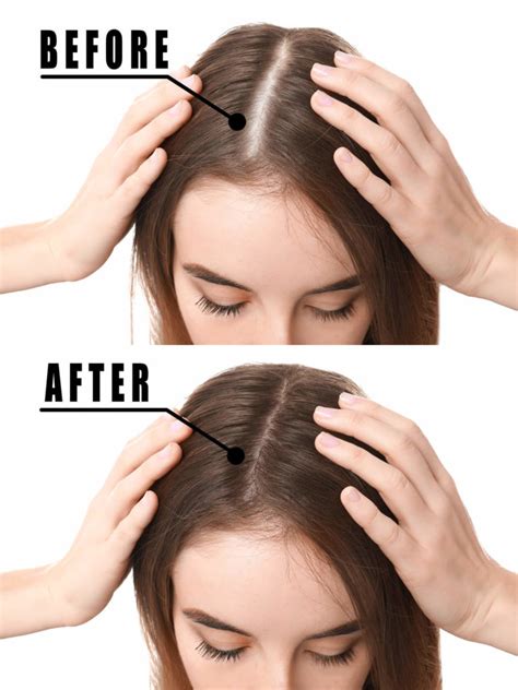 A Natural Solution For Thinning Hair