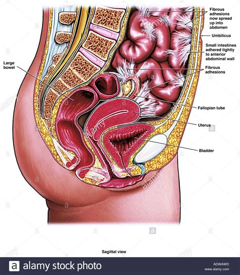 This medical exhibit diagram illustrates the anatomy of the female abdomen and pelvis from an. Abdominal Anatomy Chart Female : Anatomy Of The Female Pelvis : Ct, mri, radiographs, anatomic ...