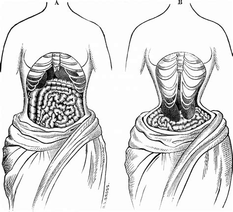 Waist Trainer Decoded With Myths And Facts Is It Really Helpful