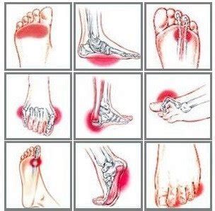 Foot pain on top and also outside of the ankle that gets better with a rest and worse with activity. Foot Pain Symptoms & How To Treat Them - Foot Pain Explored