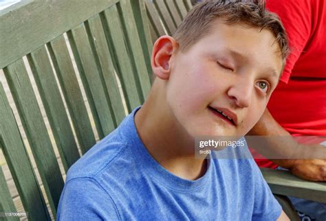 Visually Impaired 14 Year Old Boy Portrait High Res Stock Photo Getty