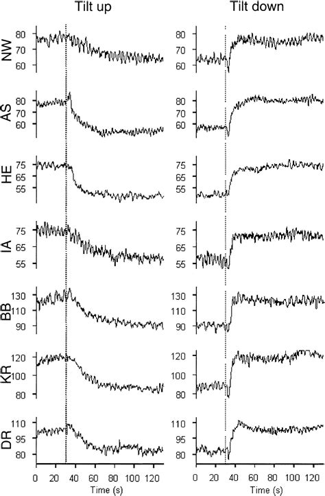 Dynamic Time Course Of Hemodynamic Responses After Passive Head Up Tilt