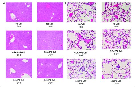 Histopathology Evaluation Of Lung And Liver After Iv Infusion Of