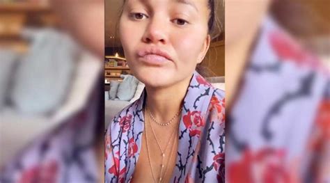 Pregnant Chrissy Teigen Jokes About Eating Too Much Sour Candy At Night 🎥 Latestly