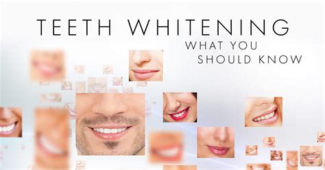 Whitening Wisdom What You Should Know Lynnfield Dental Associates Blog