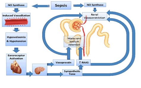 Pneumonia is an inflammatory process of one or two lungs, which is characterized by a rise in temperature, the release of fluid into the alveoli. Sepsis & AKI