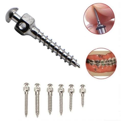 Dental Orthodontic Titanium Alloy Micro Implant Self Drilling