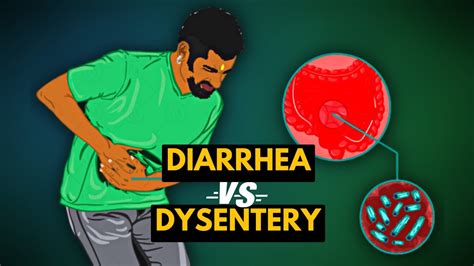 Differences Between Diarrhea And Dysentery Youtube