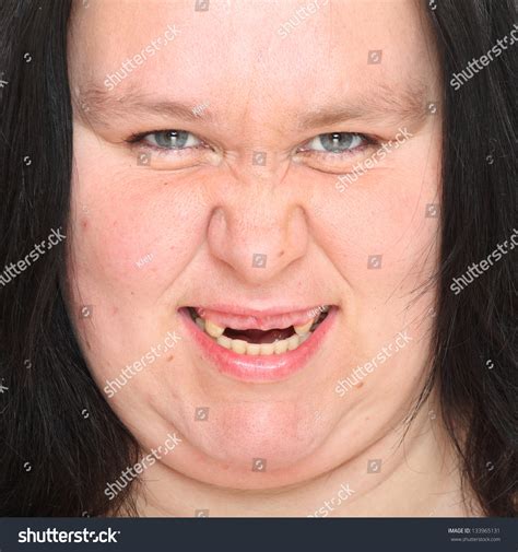 Стоковая фотография 133965131 Portrait Ugly Woman Missing Teeth Shutterstock