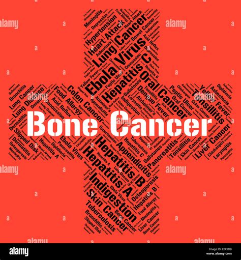 Bone Cancer Indicating Malignant Growth And Afflictions Stock Photo Alamy