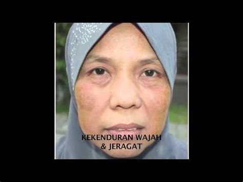 Bio miracle action limited edtion. RAWAT JERAGAT DAN PENUAAN - YouTube