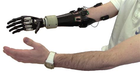 Mechanical Arm Or Prosthetic Limb But This Is The Future Mechanical Arm Prosthetics