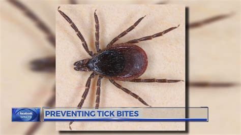 Emerging Tick Disease Might Cause Red Meat Allergy Youtube