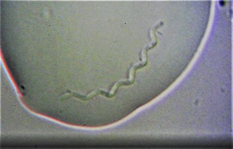 Insanely High Magnification Of Spirochete Bacteria2500x Rmicroscopy