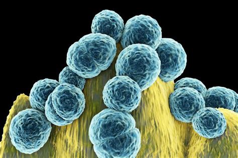 Deadly Superbug Mrsa That Is Resistant To Antibiotics Is Now Spreading