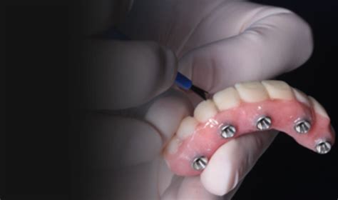 Dentista Em Lisboa JJ Dental Clinic Cuidamos Do Seu Sorriso