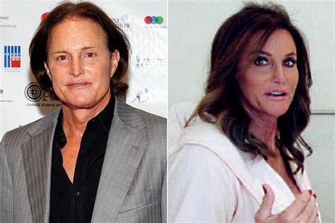 Caitlyn Jenner Plastic Surgery Before And After Celebrity Bad Plastics Surgery