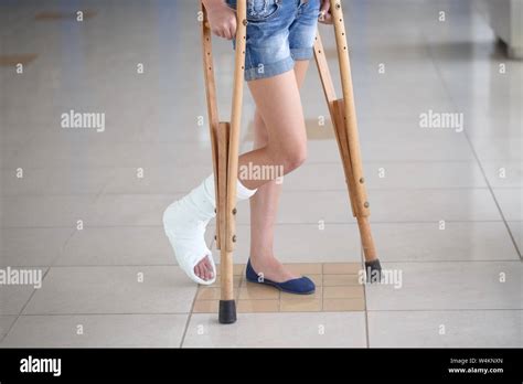 Girl On Crutches High Resolution Stock Photography And Images Alamy