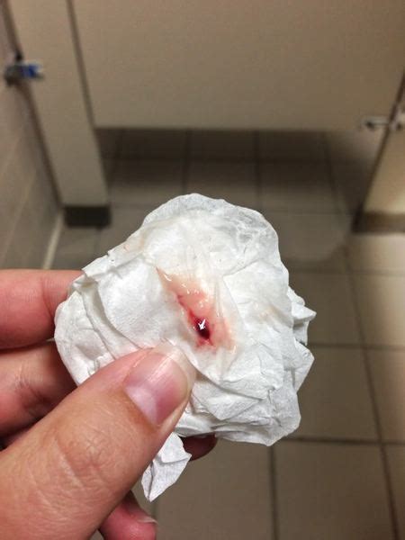 There are actually certain food and vitamins that. How soon can I test after implantation bleeding? Pic - is ...