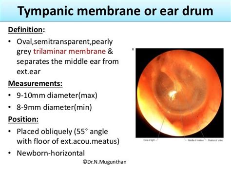 External Eartympanic Membrane And Auditory Tube Drnmugunthanms