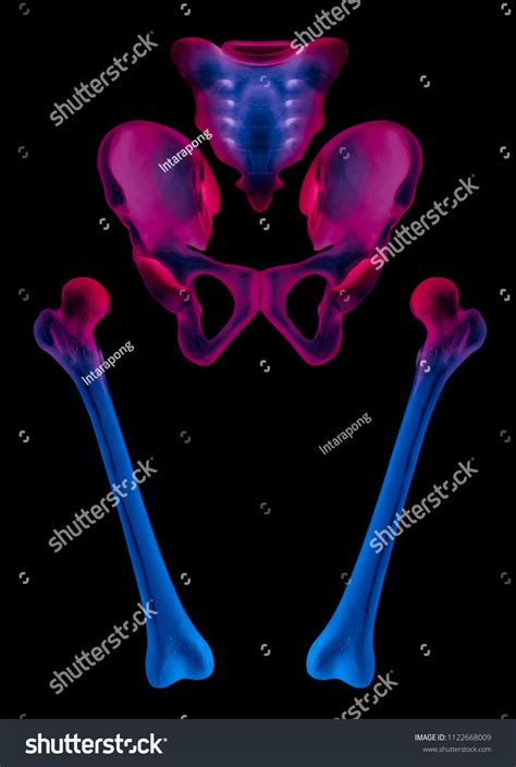 Xray Separate Human Hip Femur Bone Stock Illustration 1122668009