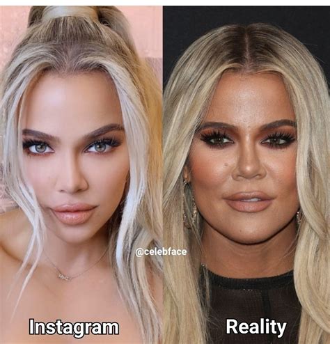 Instagram Vs Real Life Celebs Without Makeup Cheek Fillers