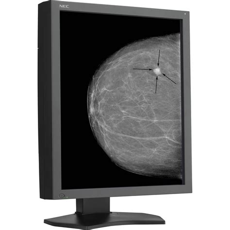 Best prices on nec multisync display grayscale tft in computer monitors. NEC 21" Grayscale 5-Megapixel Medical MD215MG-S5 B&H