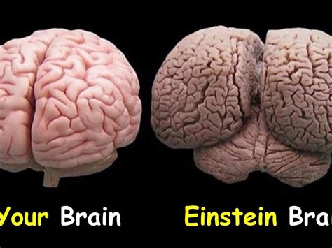 Albert Einsteins Brain And His Final Days Make Things Easier With