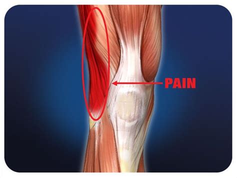Many of my clients experience lower back and hip pain simultaneously. Pin on Running