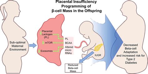 Fetal Undernutrition Placental Insufficiency And Pancreatic β Cell