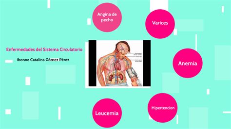 Enfermedades Del Sistema Circulatorio Humano By Catalina Gómez On Prezi