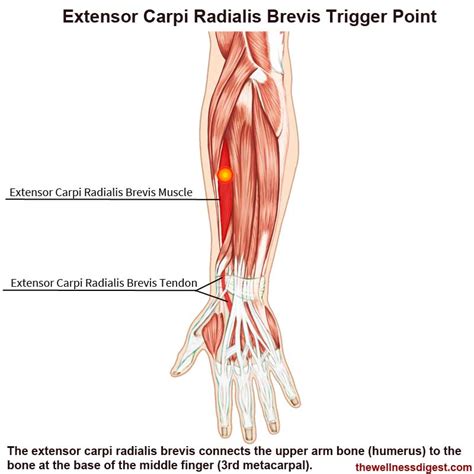 Extensor Carpi Radialis Brevis Muscle Pain The Wellness Digest