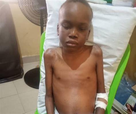 10 Year Old Stroke Patient Desperately Needs N7m For Multiple Surgeries