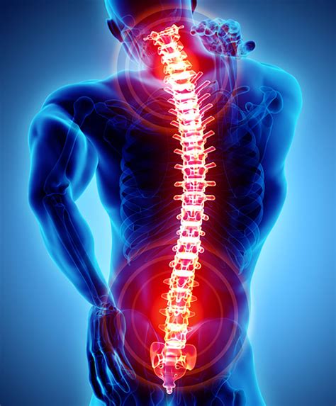 Pain Management Center Spinal Cord Stimulators And Cervical Radio Frequency Saint Francis