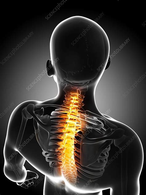 Back Pain Conceptual Artwork Stock Image F0068220 Science Photo