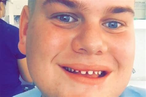 Man Spends £25k On Cosmetic Surgery After Being Brainwashed By Social Media Daily Record
