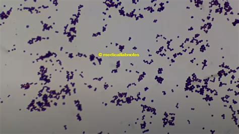 Gram Positive And Gram Negative Bacteria Introduction Differenc