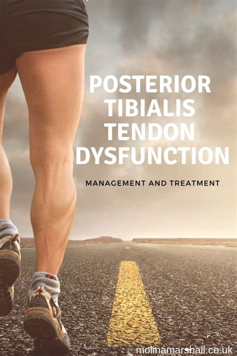 Ways To Prevent And Treat Posterior Tibial Tendonit Vrogue Co