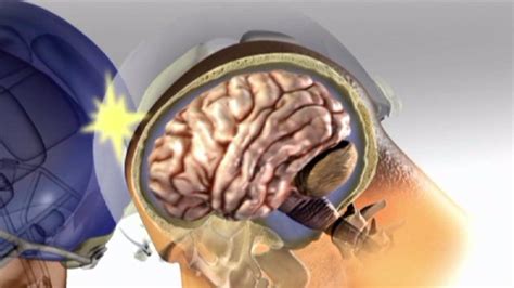 Witnesses testified on hearing on the lasting impact of head injuries suffered by national football league players and the coverage they receive from the benefits plans. "Concussion" movie sparks conversation about head injuries ...