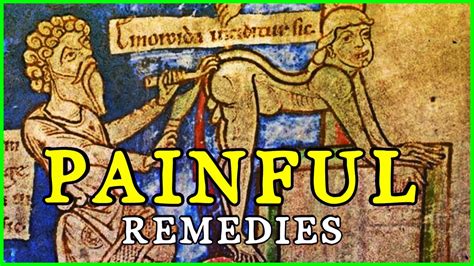 Top 5 Most Painful Medieval Surgical And Medical Treatments Youtube